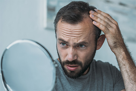 Identifying hair loss and initial considerations